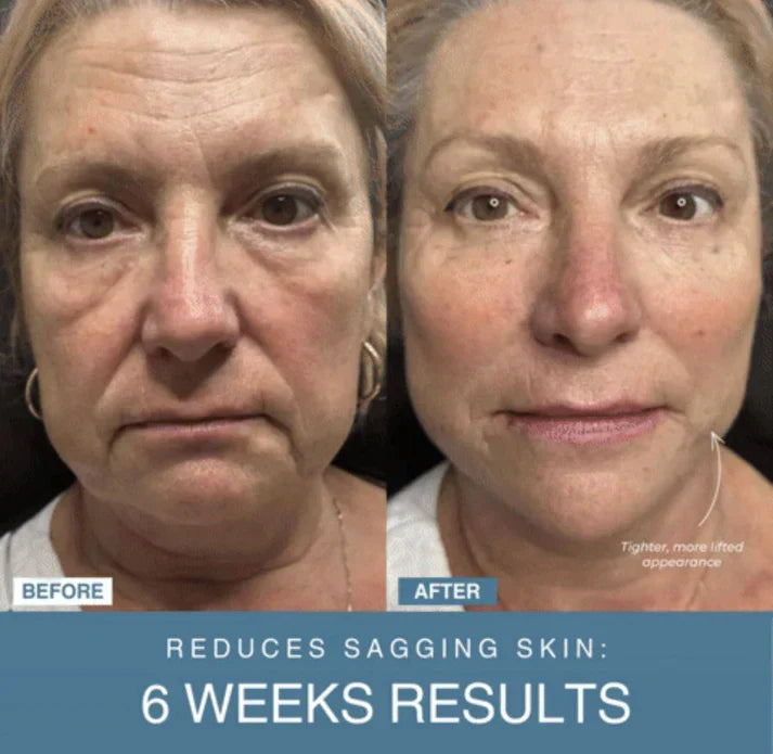ARABIAN QUEEN™ 7-in-1 LED Anti-Ageing/Wrinkle Apparatus/ Face Beauty Device – جهاز تجميل الوجه